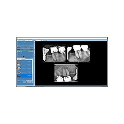 Midmark Imaging Software